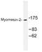 Myomesin 2 antibody, AP01485PU-N, Origene, Western Blot image 