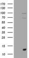 S100 Calcium Binding Protein A1 antibody, NBP2-45658, Novus Biologicals, Western Blot image 