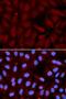 Surfactant Protein C antibody, LS-C331717, Lifespan Biosciences, Immunofluorescence image 