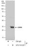 Geminin DNA Replication Inhibitor antibody, GTX116125, GeneTex, Immunoprecipitation image 