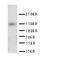 Patched 2 antibody, LS-C312999, Lifespan Biosciences, Western Blot image 