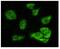 Glycogen Synthase Kinase 3 Alpha antibody, GTX83246, GeneTex, Immunofluorescence image 