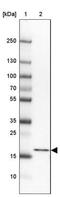 Proteasome Subunit Beta 5 antibody, NBP2-13820, Novus Biologicals, Western Blot image 