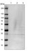 Retinol Binding Protein 4 antibody, PA5-51619, Invitrogen Antibodies, Western Blot image 