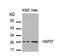 Heat Shock Protein Family B (Small) Member 1 antibody, GTX50563, GeneTex, Western Blot image 