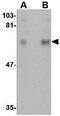 Cytoplasmic Polyadenylation Element Binding Protein 1 antibody, GTX31347, GeneTex, Western Blot image 