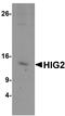 HIG1 Hypoxia Inducible Domain Family Member 2A antibody, A15905, Boster Biological Technology, Western Blot image 