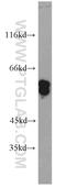 Keratin 6A antibody, 10590-1-AP, Proteintech Group, Western Blot image 