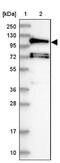 Huntingtin Interacting Protein 1 Related antibody, NBP2-38391, Novus Biologicals, Western Blot image 