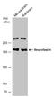 Neurofascin antibody, GTX133281, GeneTex, Western Blot image 