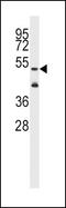 Aldehyde Dehydrogenase 1 Family Member A3 antibody, PA5-15000, Invitrogen Antibodies, Western Blot image 