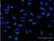 ADP Ribosylation Factor 1 antibody, H00000375-M02-100ug, Novus Biologicals, Immunofluorescence image 