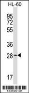 Zinc Finger DHHC-Type Containing 24 antibody, 57-097, ProSci, Western Blot image 