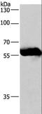 Coronin 1C antibody, LS-C404833, Lifespan Biosciences, Western Blot image 
