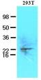Ubiquitin Conjugating Enzyme E2 S antibody, GTX53797, GeneTex, Western Blot image 