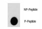 AKT Serine/Threonine Kinase 2 antibody, F48486-0.4ML, NSJ Bioreagents, Dot Blot image 