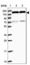 Transient receptor potential cation channel subfamily M member 4 antibody, NBP2-13487, Novus Biologicals, Western Blot image 