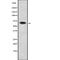 Nuclear Receptor Subfamily 5 Group A Member 2 antibody, abx217236, Abbexa, Western Blot image 