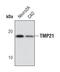 Transmembrane P24 Trafficking Protein 10 antibody, PA5-17126, Invitrogen Antibodies, Western Blot image 