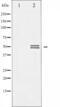 Glycogen Synthase Kinase 3 Alpha antibody, abx010869, Abbexa, Western Blot image 