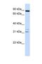 ADAM Metallopeptidase Domain 19 antibody, NBP1-69367, Novus Biologicals, Western Blot image 