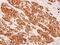 Keratin 8 antibody, GTX112975, GeneTex, Immunohistochemistry paraffin image 