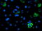 Acyl-CoA Synthetase Medium Chain Family Member 5 antibody, M14033, Boster Biological Technology, Immunofluorescence image 