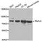 Transient Receptor Potential Cation Channel Subfamily V Member 5 antibody, A6473, ABclonal Technology, Western Blot image 