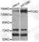 Integrin Subunit Alpha 2 antibody, A7629, ABclonal Technology, Western Blot image 