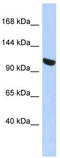 Ubiquitin Like Modifier Activating Enzyme 1 antibody, TA344241, Origene, Western Blot image 