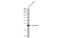 Lipocalin 2 antibody, GTX132952, GeneTex, Western Blot image 