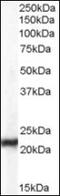 Chromobox 5 antibody, orb88171, Biorbyt, Western Blot image 