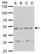 Calcium/Calmodulin Dependent Protein Kinase II Delta antibody, LS-B10795, Lifespan Biosciences, Western Blot image 
