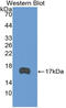 TEK Receptor Tyrosine Kinase antibody, LS-C314407, Lifespan Biosciences, Western Blot image 