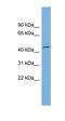 Vesicle Amine Transport 1 antibody, orb325723, Biorbyt, Western Blot image 