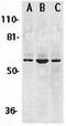 Checkpoint Kinase 2 antibody, GTX31659, GeneTex, Western Blot image 