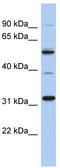 TBC1 Domain Family Member 26 antibody, TA333423, Origene, Western Blot image 