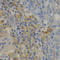 P21 (RAC1) Activated Kinase 1 antibody, A3279, ABclonal Technology, Immunohistochemistry paraffin image 