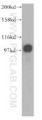 TPX2 Microtubule Nucleation Factor antibody, 11741-1-AP, Proteintech Group, Western Blot image 
