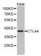 Cytotoxic T-Lymphocyte Associated Protein 4 antibody, abx001680, Abbexa, Western Blot image 