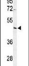 Ribosome Biogenesis Regulator 1 Homolog antibody, PA5-24677, Invitrogen Antibodies, Western Blot image 