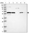 Rubicon Like Autophagy Enhancer antibody, PA5-55357, Invitrogen Antibodies, Western Blot image 