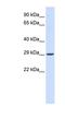 Vesicle Transport Through Interaction With T-SNAREs 1A antibody, NBP1-91431, Novus Biologicals, Western Blot image 