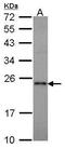 RAP1A, Member Of RAS Oncogene Family antibody, PA5-21457, Invitrogen Antibodies, Western Blot image 