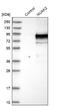 NUAK family SNF1-like kinase 2 antibody, NBP1-81880, Novus Biologicals, Western Blot image 