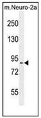 DEAD/H-Box Helicase 11 antibody, AP51215PU-N, Origene, Western Blot image 