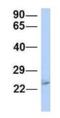 Proteasome Subunit Beta 2 antibody, NBP1-54590, Novus Biologicals, Western Blot image 