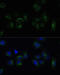 Clathrin Light Chain B antibody, 23-560, ProSci, Immunofluorescence image 