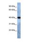 Transmembrane Protein 115 antibody, NBP1-69572, Novus Biologicals, Western Blot image 