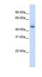 Negative Elongation Factor Complex Member E antibody, NBP1-57196, Novus Biologicals, Western Blot image 